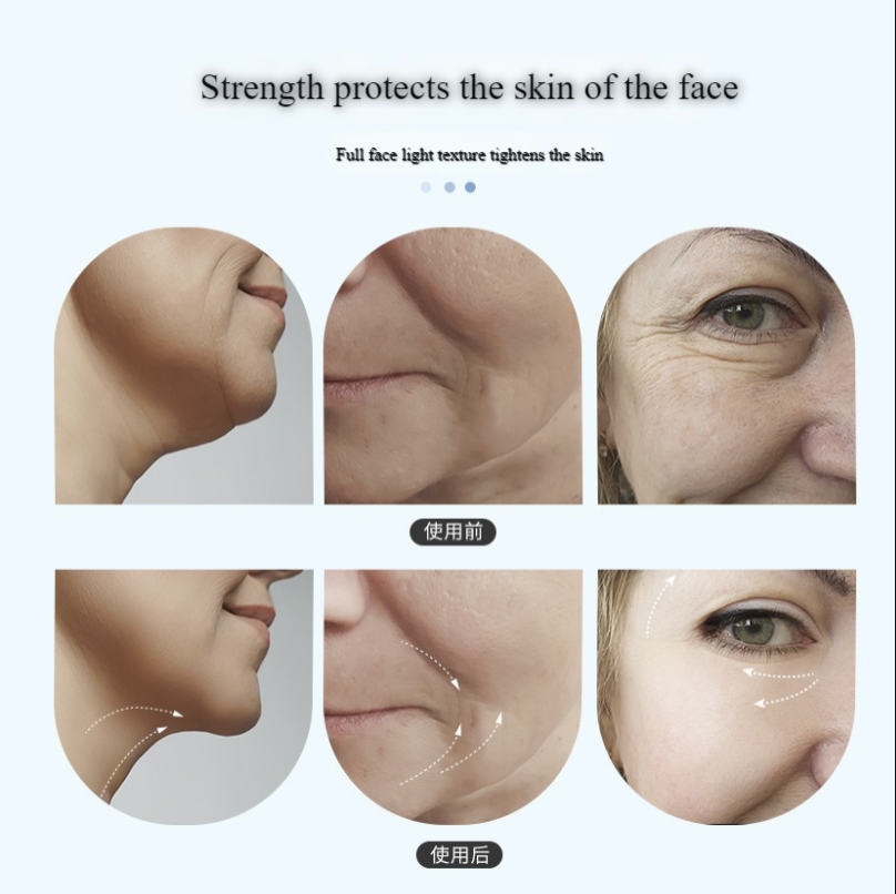 Microcurrent Massager 5